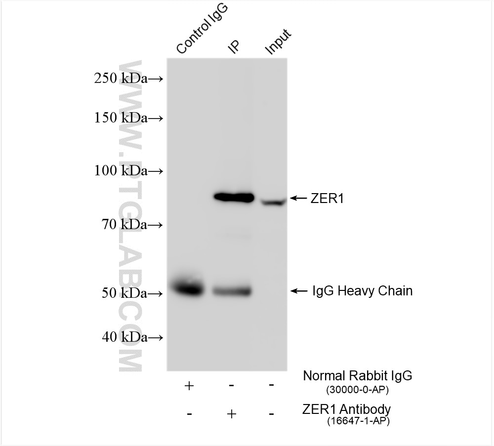 Immunoprecipitation (IP) experiment of mouse testis tissue using ZER1 Polyclonal antibody (16647-1-AP)
