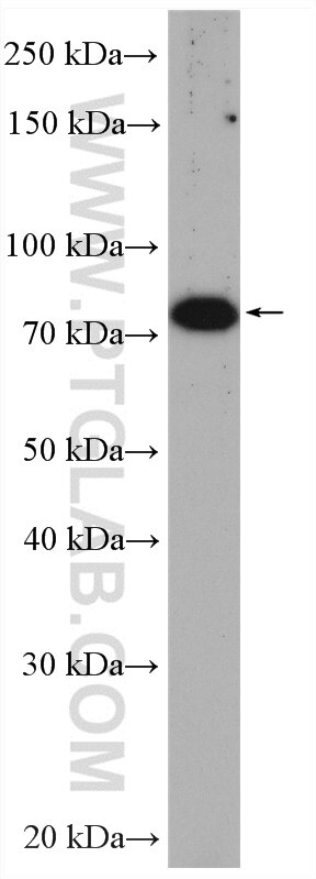Western Blot (WB) analysis of rat testis tissue using ZER1 Polyclonal antibody (16647-1-AP)