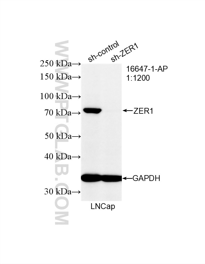 Western Blot (WB) analysis of LNCaP cells using ZER1 Polyclonal antibody (16647-1-AP)