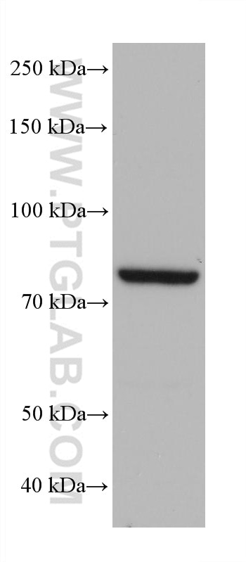 Western Blot (WB) analysis of Jurkat cells using ZER1 Monoclonal antibody (68258-1-Ig)