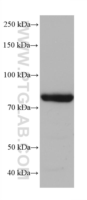 Western Blot (WB) analysis of LNCaP cells using ZER1 Monoclonal antibody (68258-1-Ig)