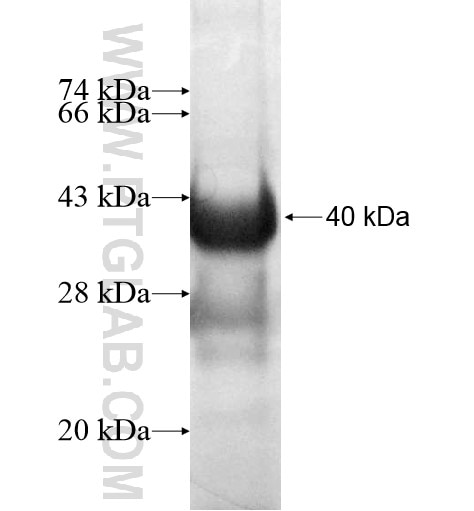 ZFAND3 fusion protein Ag11462 SDS-PAGE ZFAND3 fusion protein Ag11462 SDS-PAGE