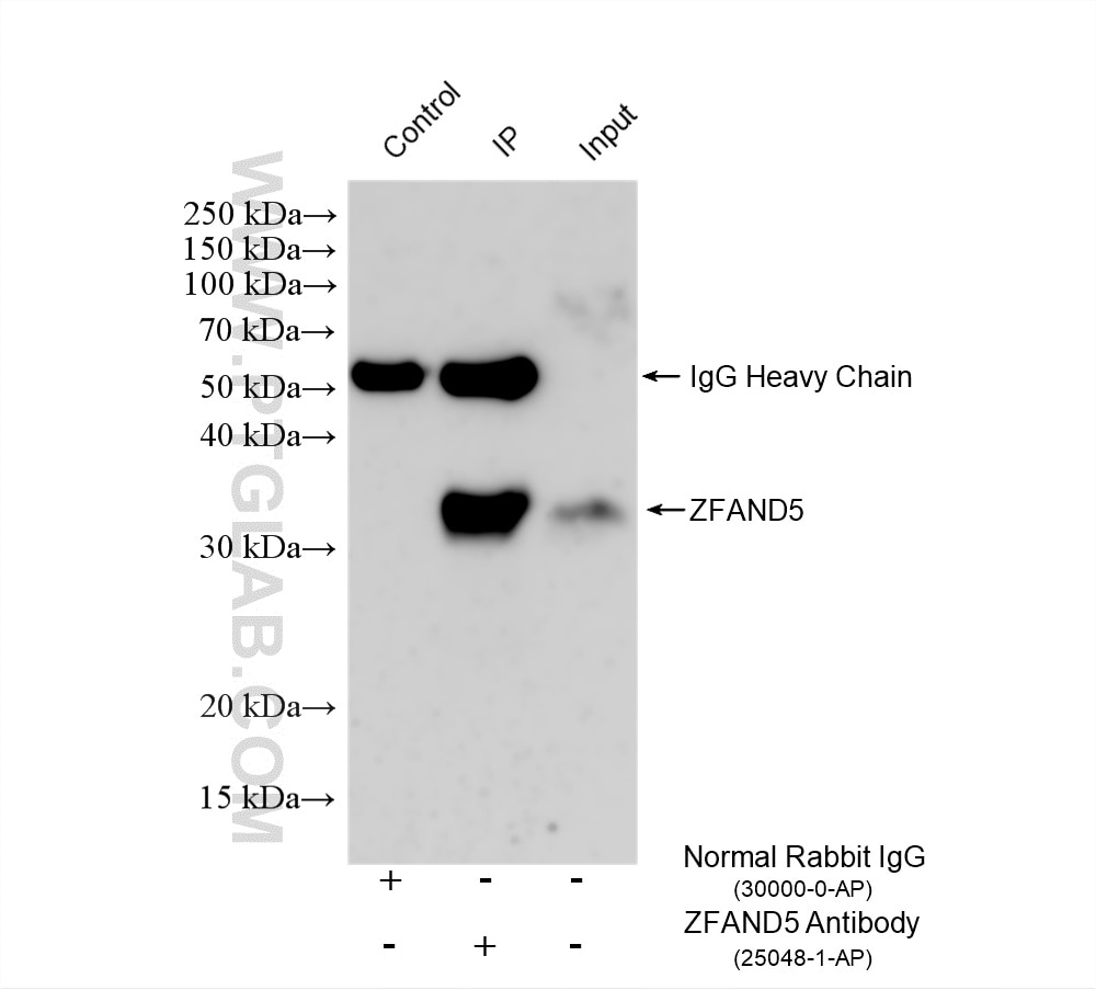 IP experiment of mouse brain using 25048-1-AP (same clone as 25048-1-PBS) Immunoprecipitation (IP) experiment of mouse brain tissue using ZFAND5 Polyclonal antibody (25048-1-AP)
