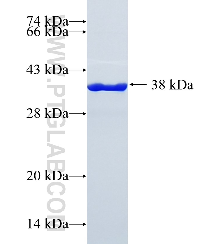 ZFAND5 fusion protein Ag19311 SDS-PAGE