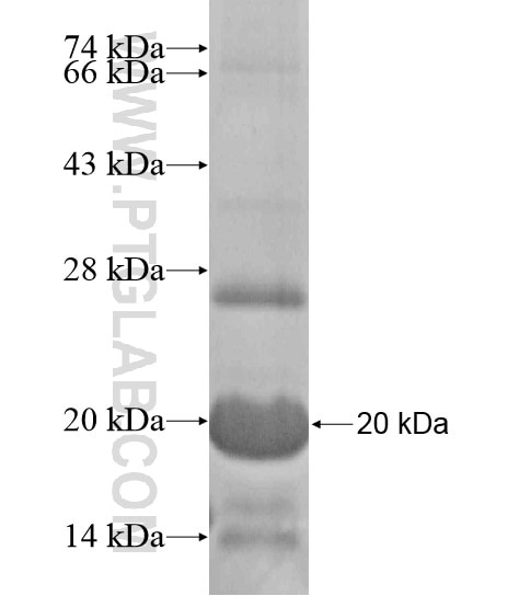 ZFAND5 fusion protein Ag19441 SDS-PAGE