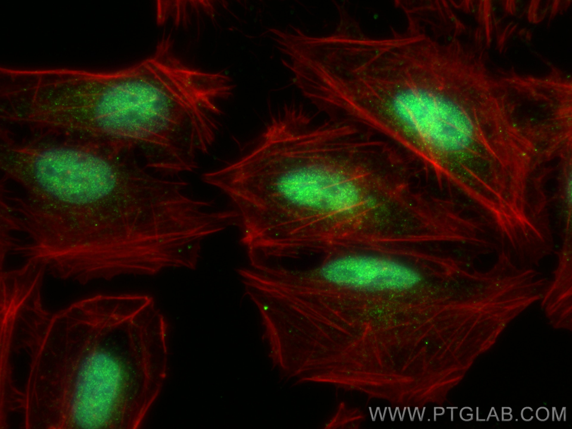 Immunofluorescent analysis of (4% PFA) fixed U2OS cells using ZFC3H1 antibody (30834-1-AP) at dilution of 1:400 and CoraLite®488-Conjugated Goat Anti-Rabbit IgG(H+L) (SA00013-2), CL594-Phalloidin (red). Immunofluorescence (IF) / fluorescent staining of U2OS cells using ZFC3H1 Polyclonal antibody (30834-1-AP)