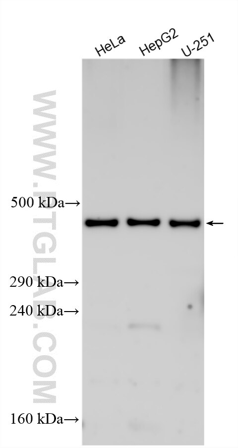 Western Blot (WB) analysis of various lysates using ZFHX4 Polyclonal antibody (31404-1-AP)