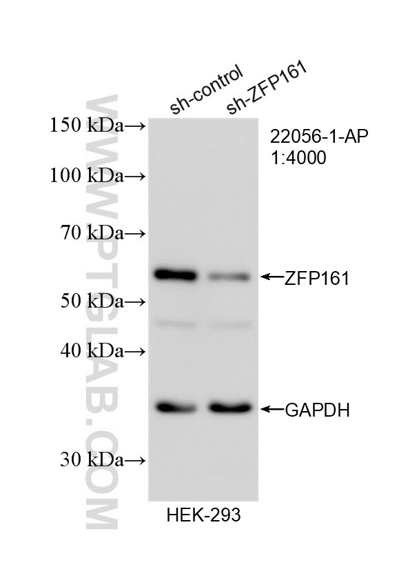 Western Blot (WB) analysis of HEK-293 cells using ZFP161 / ZBTB14 Polyclonal antibody (22056-1-AP)