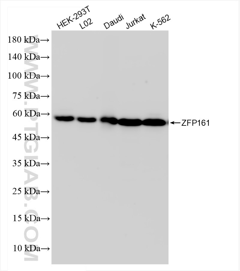 Western Blot (WB) analysis of various lysates using ZFP161 Recombinant antibody (83909-4-RR)
