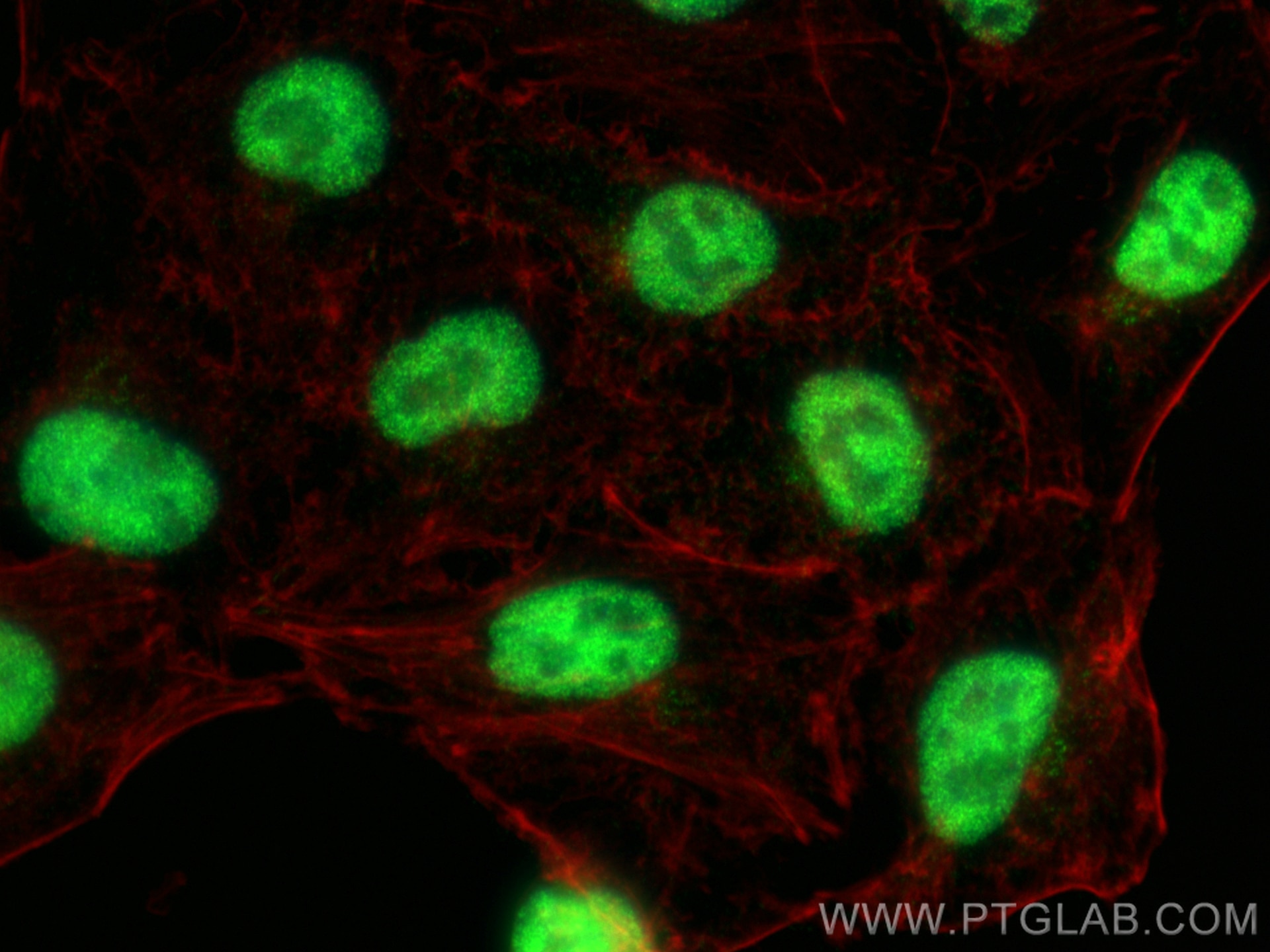 Immunofluorescence (IF) / fluorescent staining of A549 cells using ZFP161 / ZBTB14 Recombinant antibody (83909-5-RR)