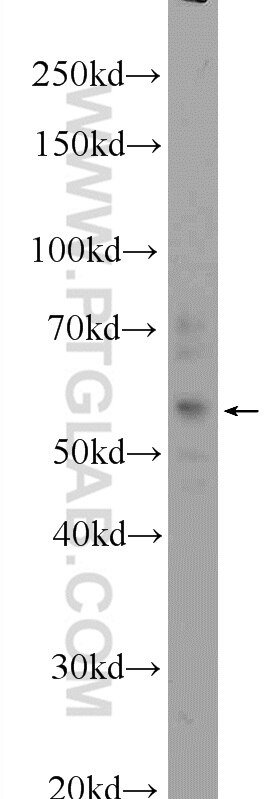Western Blot (WB) analysis of HepG2 cells using ZFP2 Polyclonal antibody (24720-1-AP)