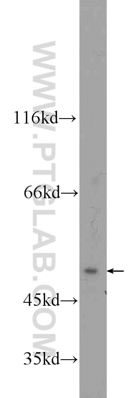 Western Blot (WB) analysis of Neuro-2a cells using ZFP2 Polyclonal antibody (24720-1-AP)