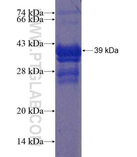 ZFP2 fusion protein Ag20087 SDS-PAGE