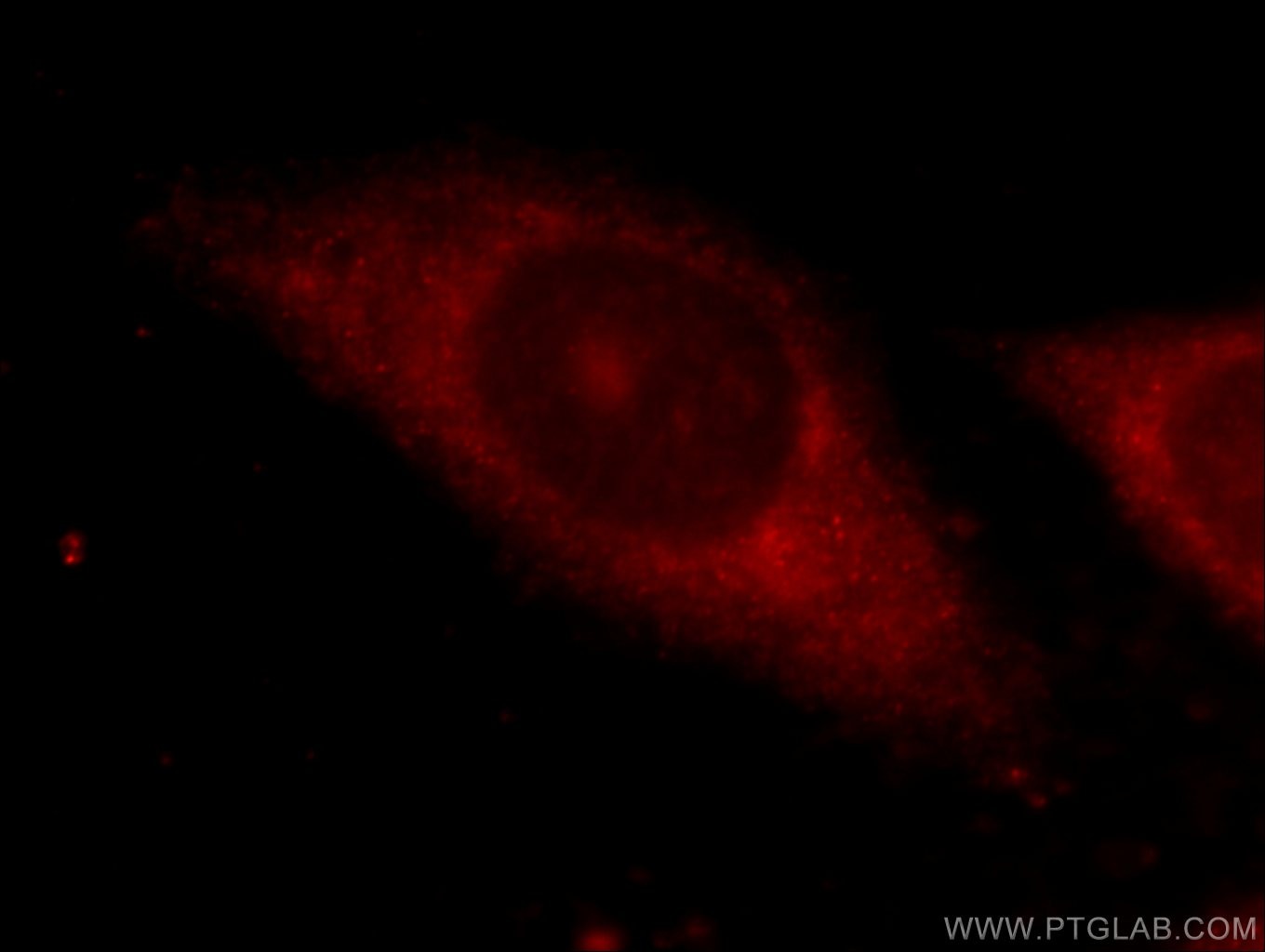 Immunofluorescence (IF) / fluorescent staining of HepG2 cells using ZFP36 Polyclonal antibody (12737-1-AP)