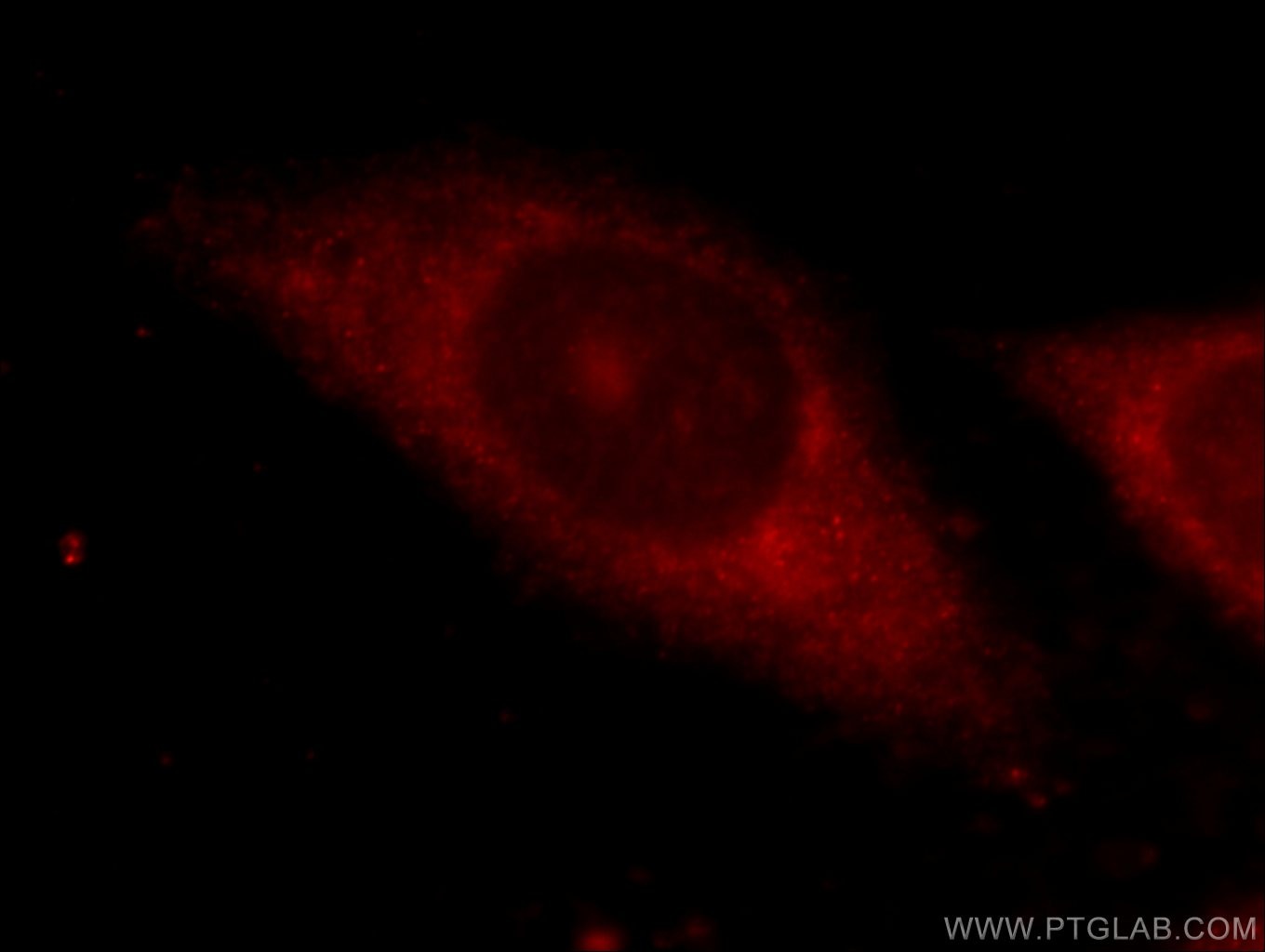 IF Staining of HepG2 using 12737-1-AP