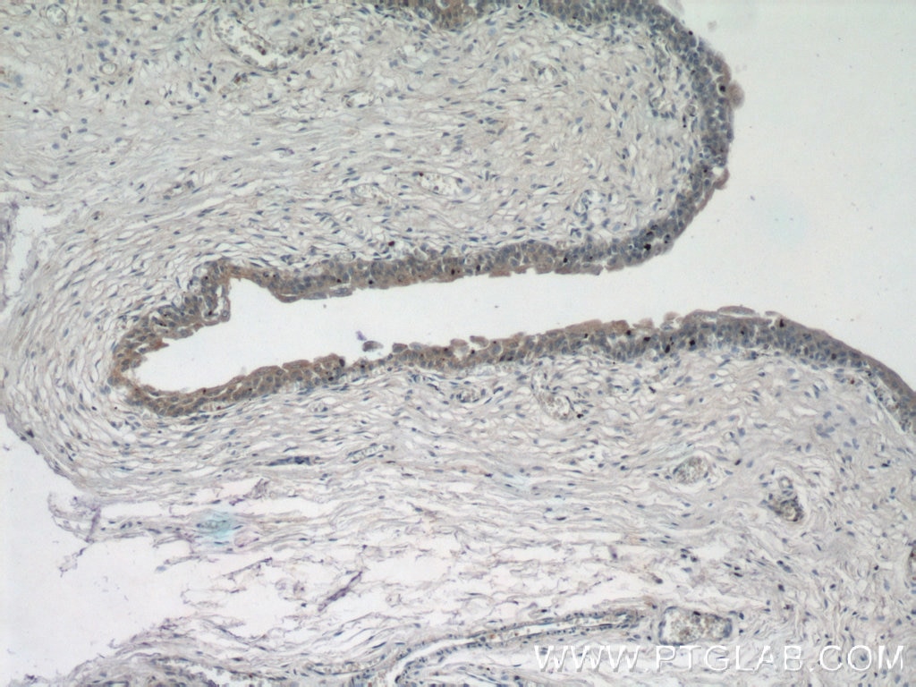 Immunohistochemistry (IHC) staining of human bladder tissue using ZFP36 Polyclonal antibody (12737-1-AP)