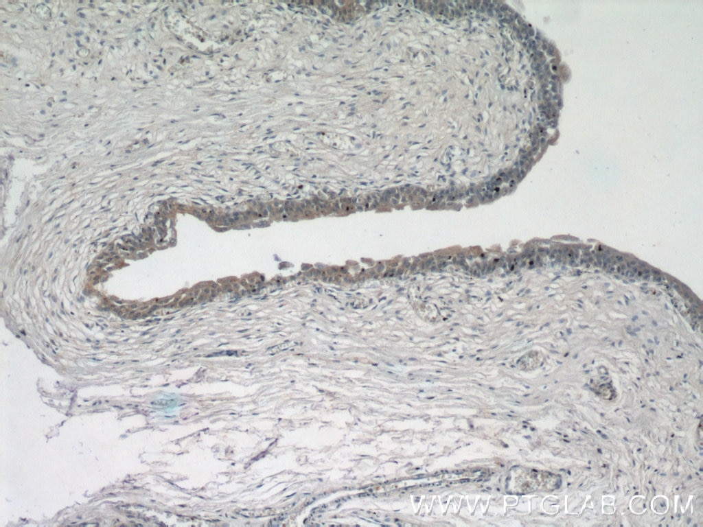 IHC staining of human bladder using 12737-1-AP