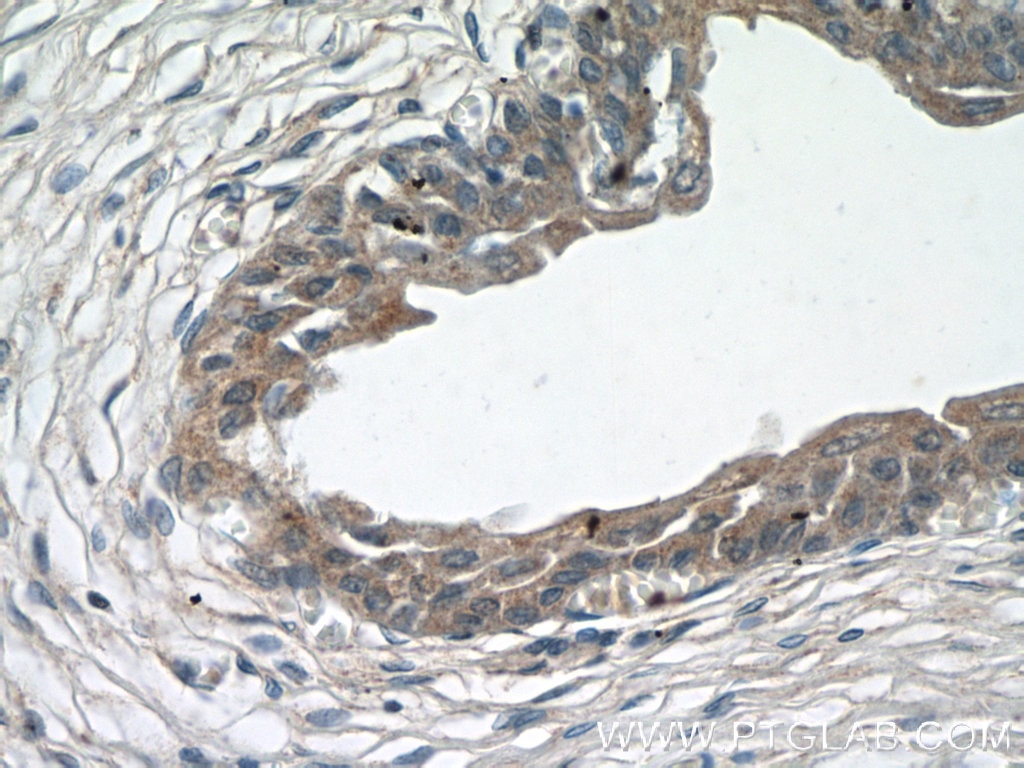 Immunohistochemistry (IHC) staining of human bladder tissue using ZFP36 Polyclonal antibody (12737-1-AP)