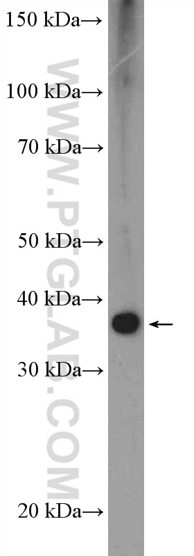 Western Blot (WB) analysis of mouse lung tissue using ZFP36 Polyclonal antibody (12737-1-AP)