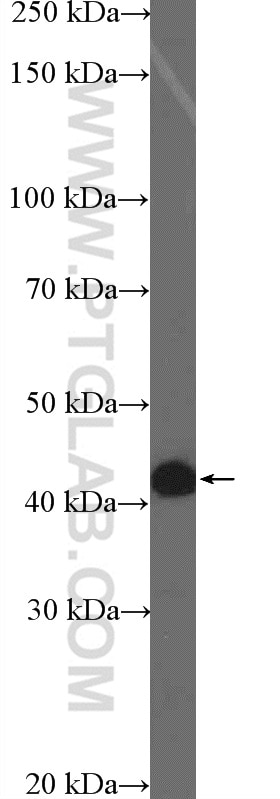 Western Blot (WB) analysis of A549 cells using ZFP36 Polyclonal antibody (12737-1-AP)
