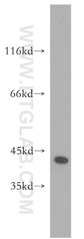 WB analysis of mouse lung using 12737-1-AP