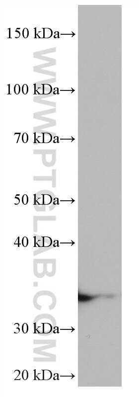 Western Blot (WB) analysis of A549 cells using ZFP36 Monoclonal antibody (66938-1-Ig)