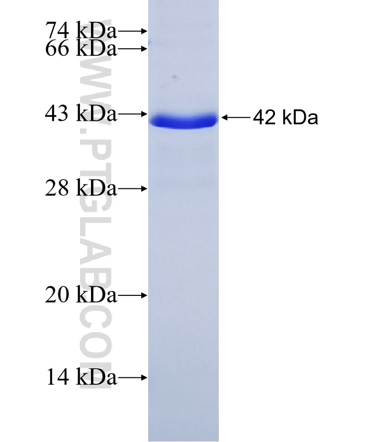 ZFP36 fusion protein Ag28473 SDS-PAGE