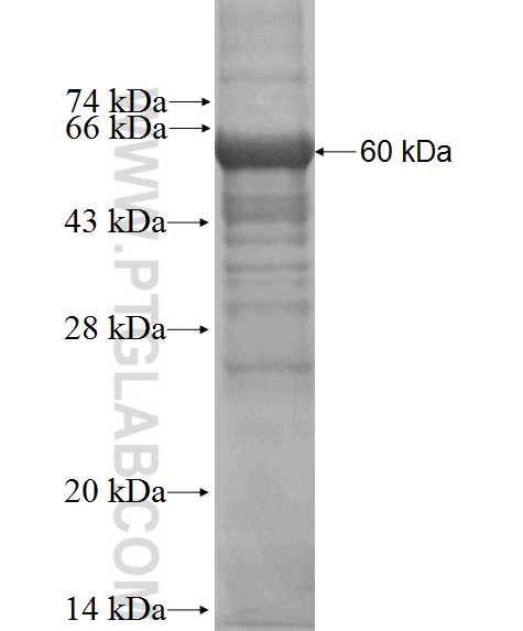 ZFP36 fusion protein Ag3461 SDS-PAGE