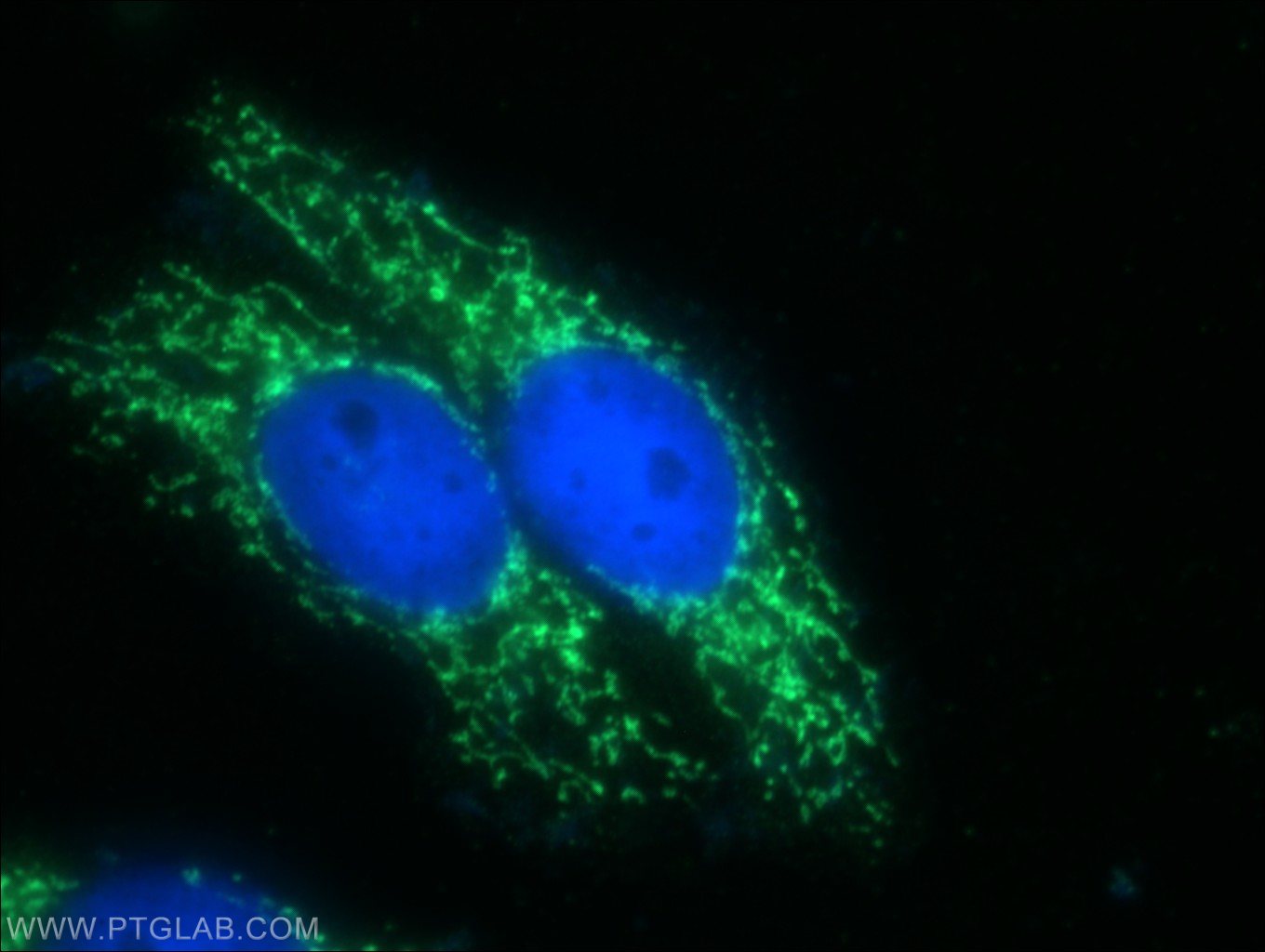 Immunofluorescence (IF) / fluorescent staining of HepG2 cells using ZFP36L1/2 Polyclonal antibody (12306-1-AP)