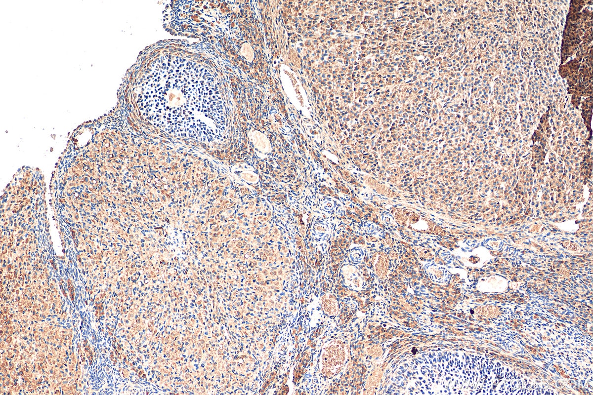 Immunohistochemistry (IHC) staining of rat ovary tissue using ZFP36L1/2 Polyclonal antibody (12306-1-AP)