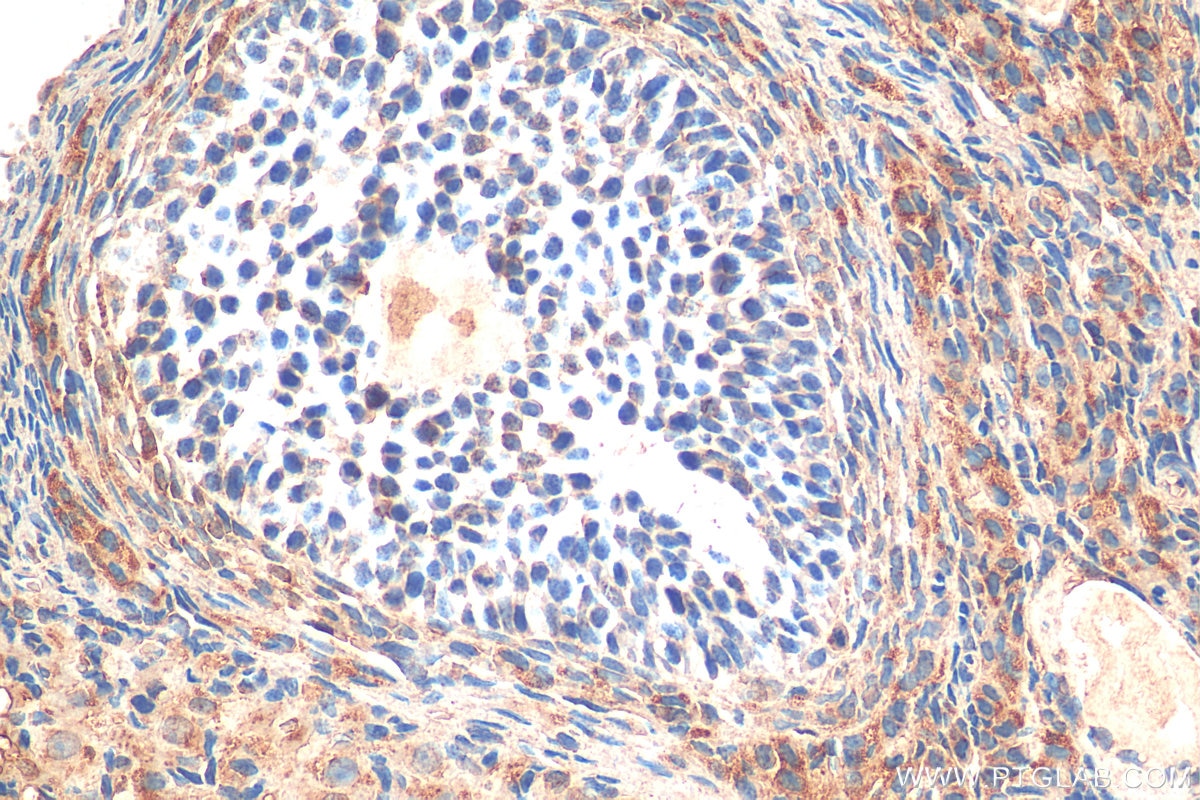 Immunohistochemistry (IHC) staining of rat ovary tissue using ZFP36L1/2 Polyclonal antibody (12306-1-AP)