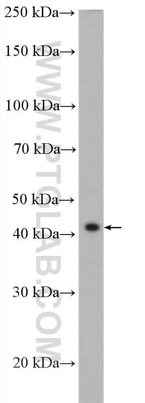 Western Blot (WB) analysis of U-937 cells using ZFP36L1/2 Polyclonal antibody (12306-1-AP)