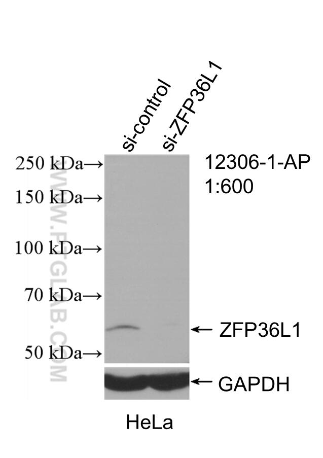 Western Blot (WB) analysis of HeLa cells using ZFP36L1/2 Polyclonal antibody (12306-1-AP)