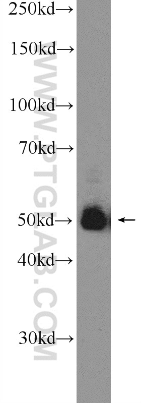 Western Blot (WB) analysis of RAW 264.7 cells using ZFP36L1/2 Polyclonal antibody (12306-1-AP)