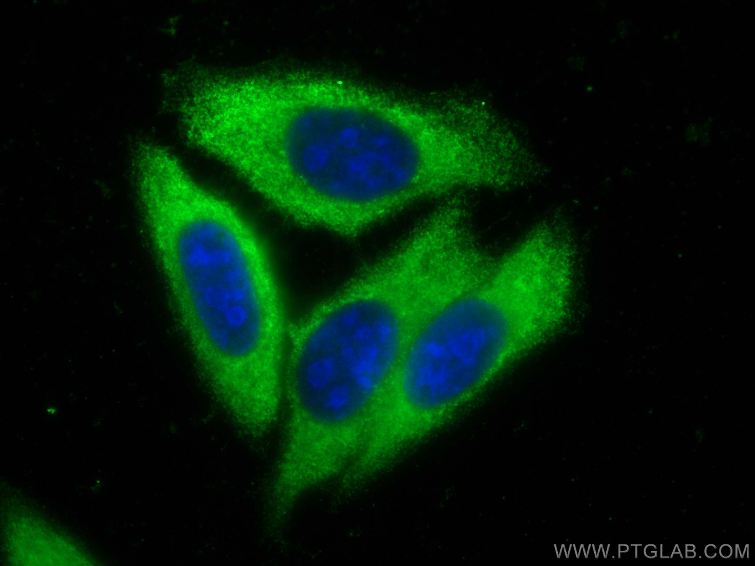 Immunofluorescence (IF) / fluorescent staining of HepG2 cells using ZFP36L1 Monoclonal antibody (68038-1-Ig)