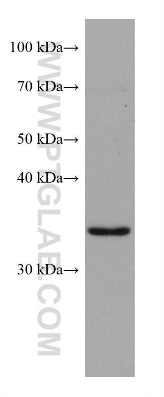 Western Blot (WB) analysis of HSC-T6 cells using ZFP36L1 Monoclonal antibody (68038-1-Ig)