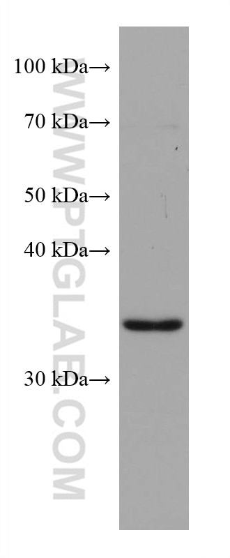 Western Blot (WB) analysis of HSC-T6 cells using ZFP36L1 Monoclonal antibody (68038-1-Ig)