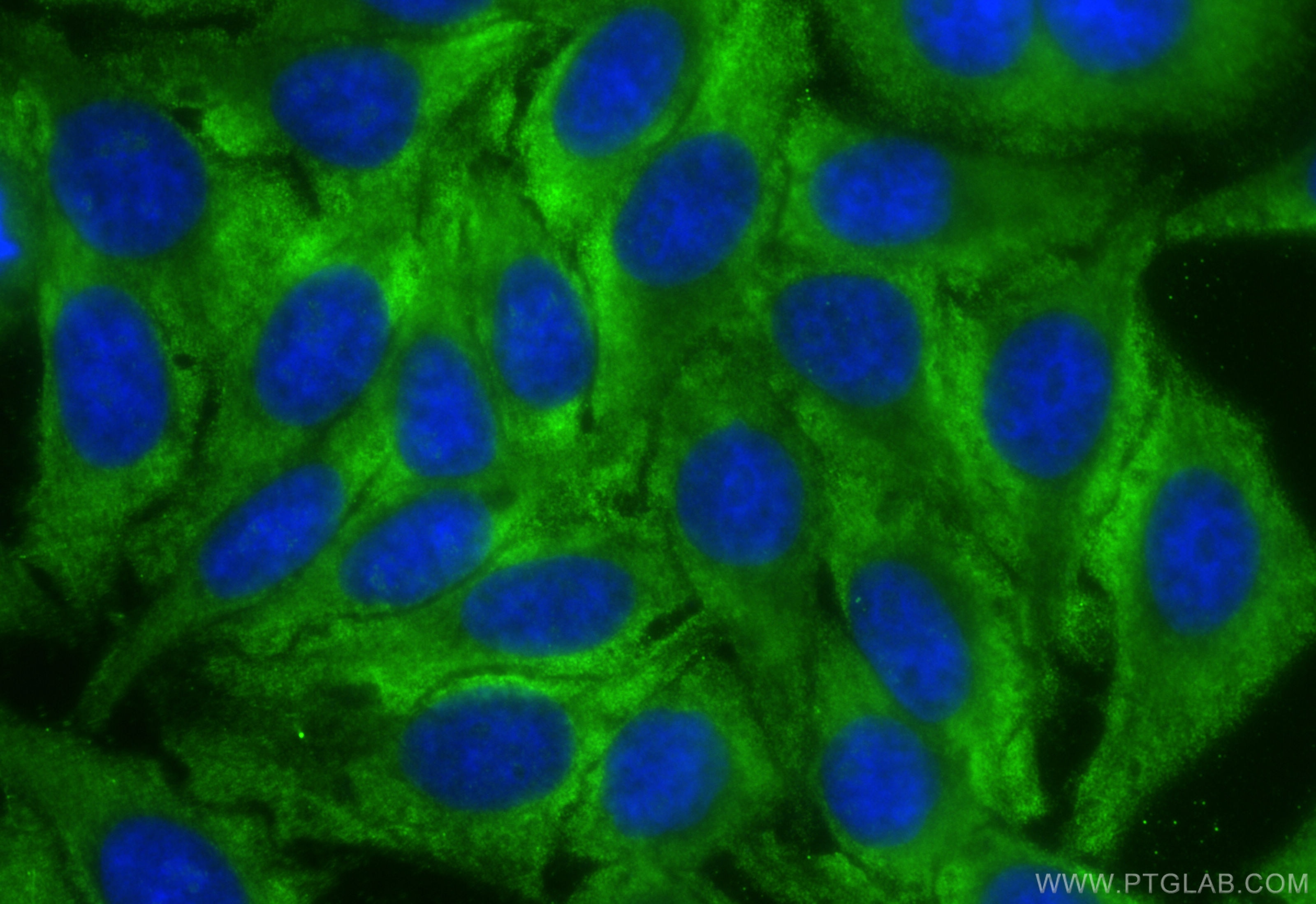 Immunofluorescence (IF) / fluorescent staining of HepG2 cells using CoraLite® Plus 488-conjugated ZFP36L1 Monoclonal a (CL488-68038)