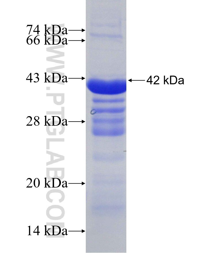 ZFP36L1 fusion protein Ag30469 SDS-PAGE