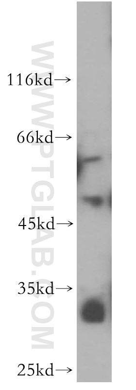 Western Blot (WB) analysis of HL-60 cells using ZFP36L2 Polyclonal antibody (19005-1-AP)