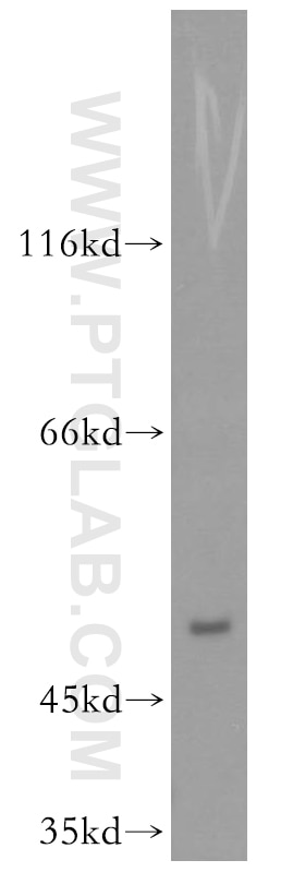 WB analysis of HepG2 using 19005-1-AP