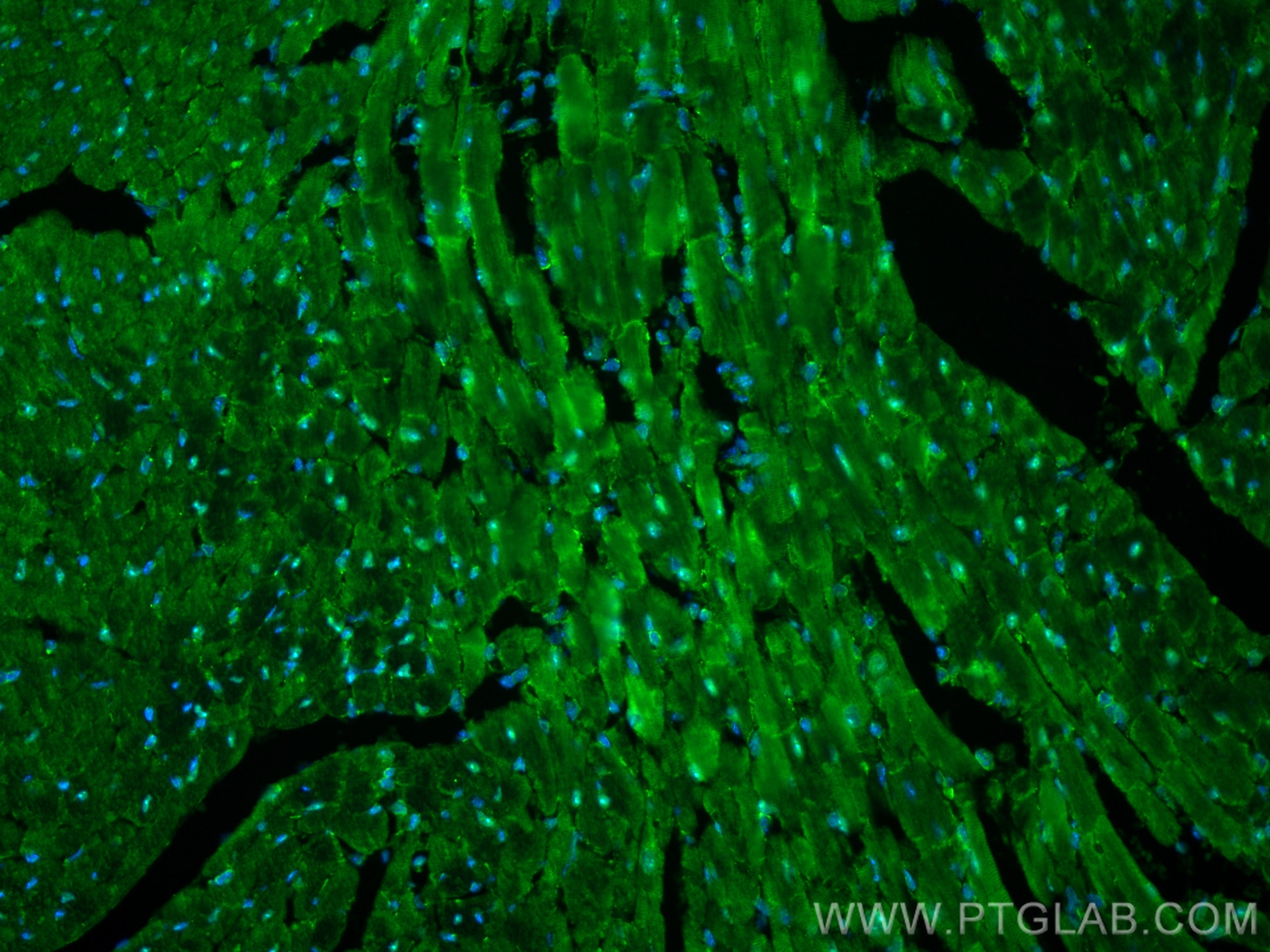 Immunofluorescence (IF) / fluorescent staining of mouse heart tissue using ZFP36L2 Polyclonal antibody (30640-1-AP)