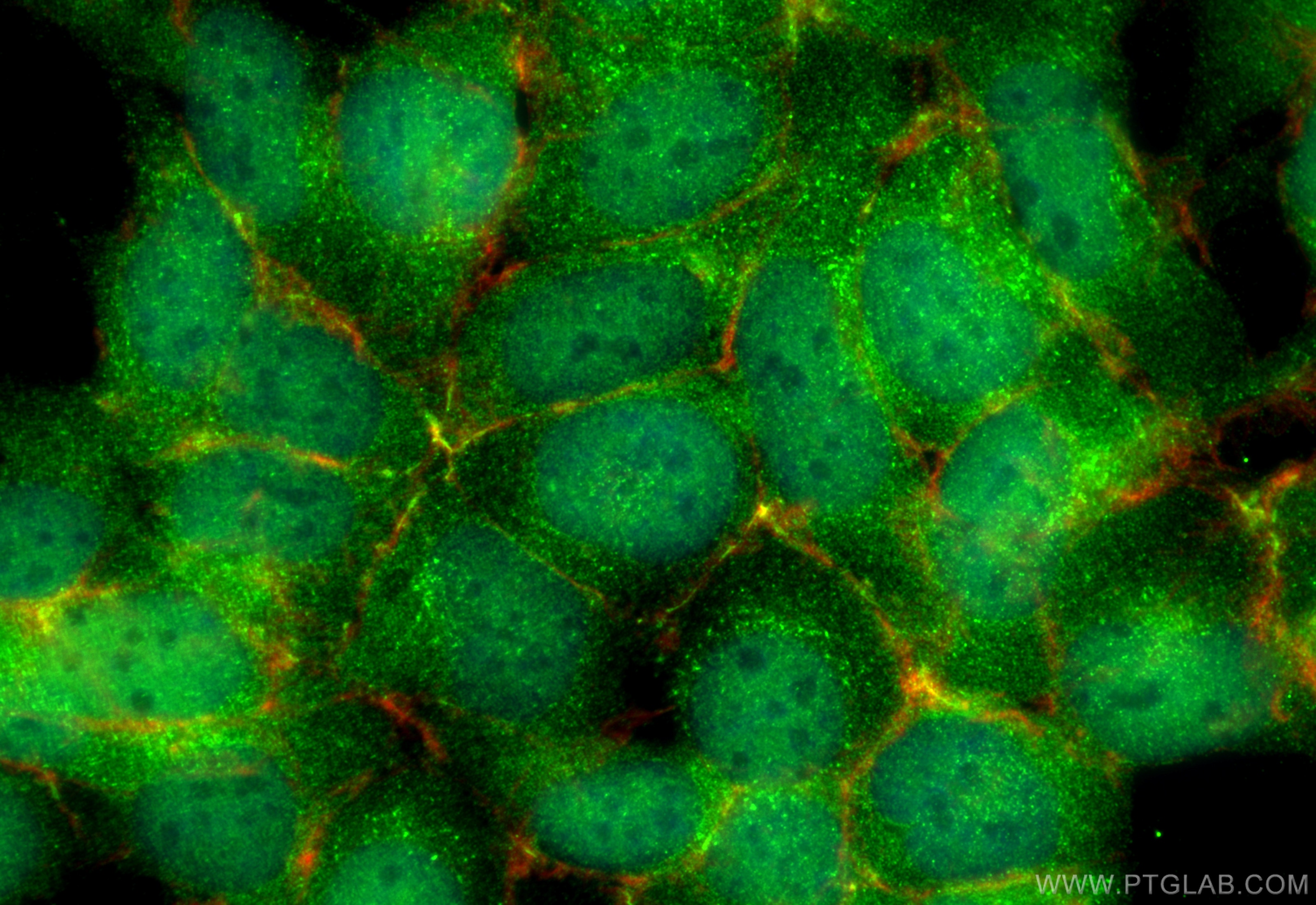 Immunofluorescence (IF) / fluorescent staining of HEK-293 cells using ZFP36L2 Polyclonal antibody (30640-1-AP)