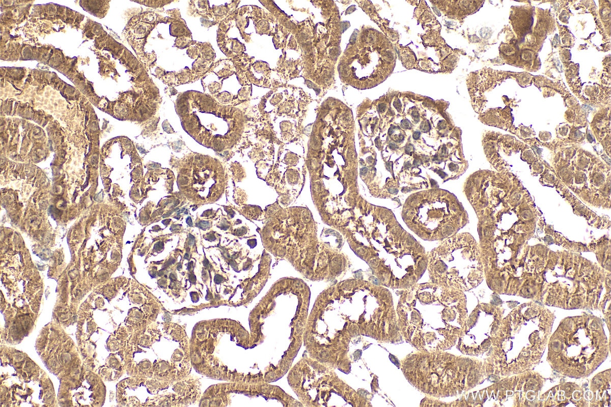 Immunohistochemistry (IHC) staining of mouse kidney tissue using ZFP36L2 Polyclonal antibody (30640-1-AP)
