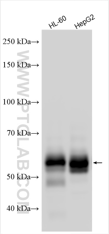 Western Blot (WB) analysis of various lysates using ZFP36L2 Polyclonal antibody (30640-1-AP)