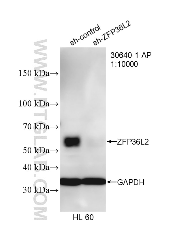 Western Blot (WB) analysis of HL-60 cells using ZFP36L2 Polyclonal antibody (30640-1-AP)