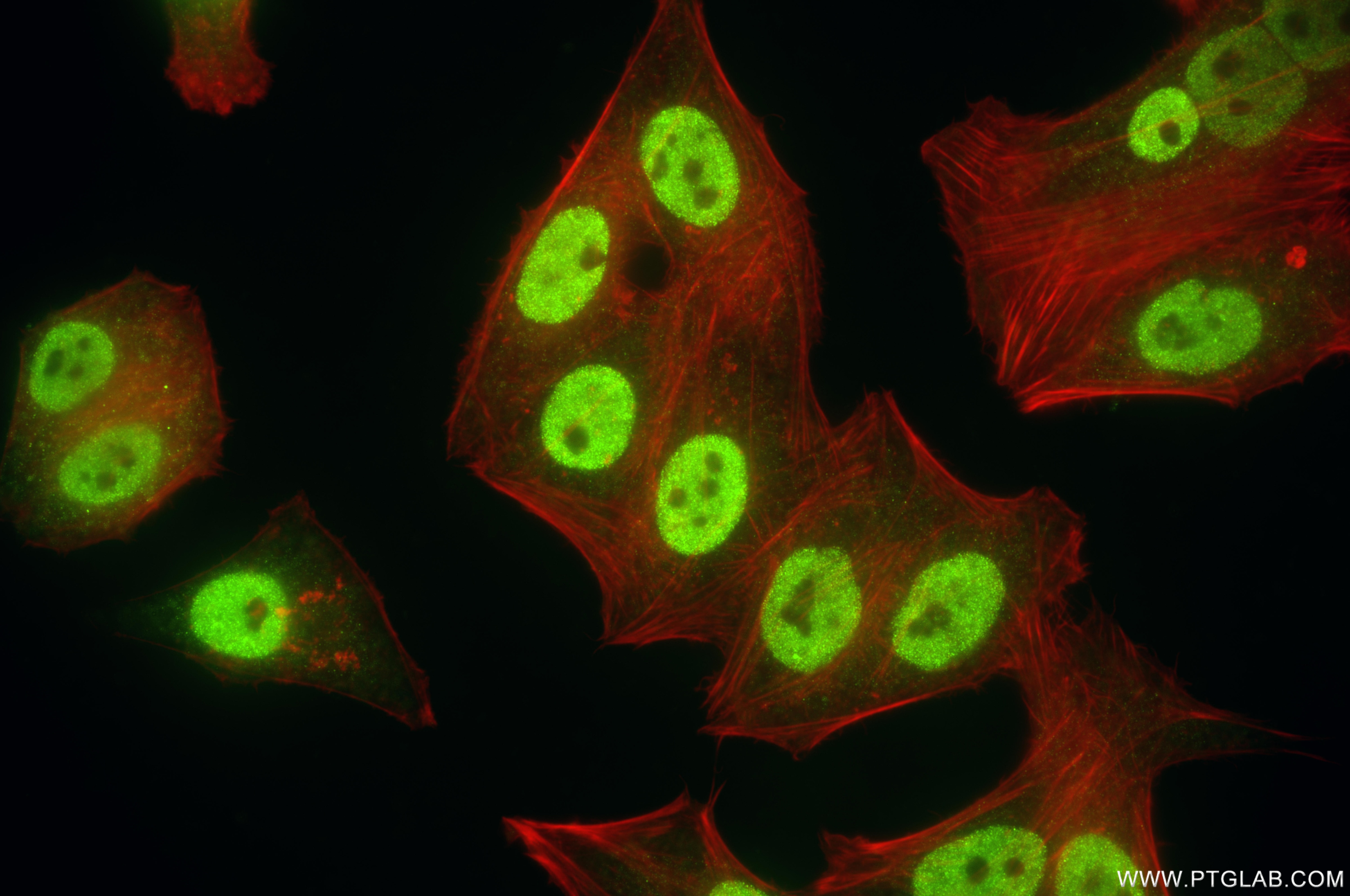 Immunofluorescence (IF) / fluorescent staining of HepG2 cells using ZFP36L2 Recombinant antibody (85154-4-RR)
