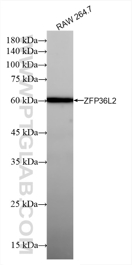 Western Blot (WB) analysis of various lysates using ZFP36L2 Recombinant antibody (85154-4-RR)