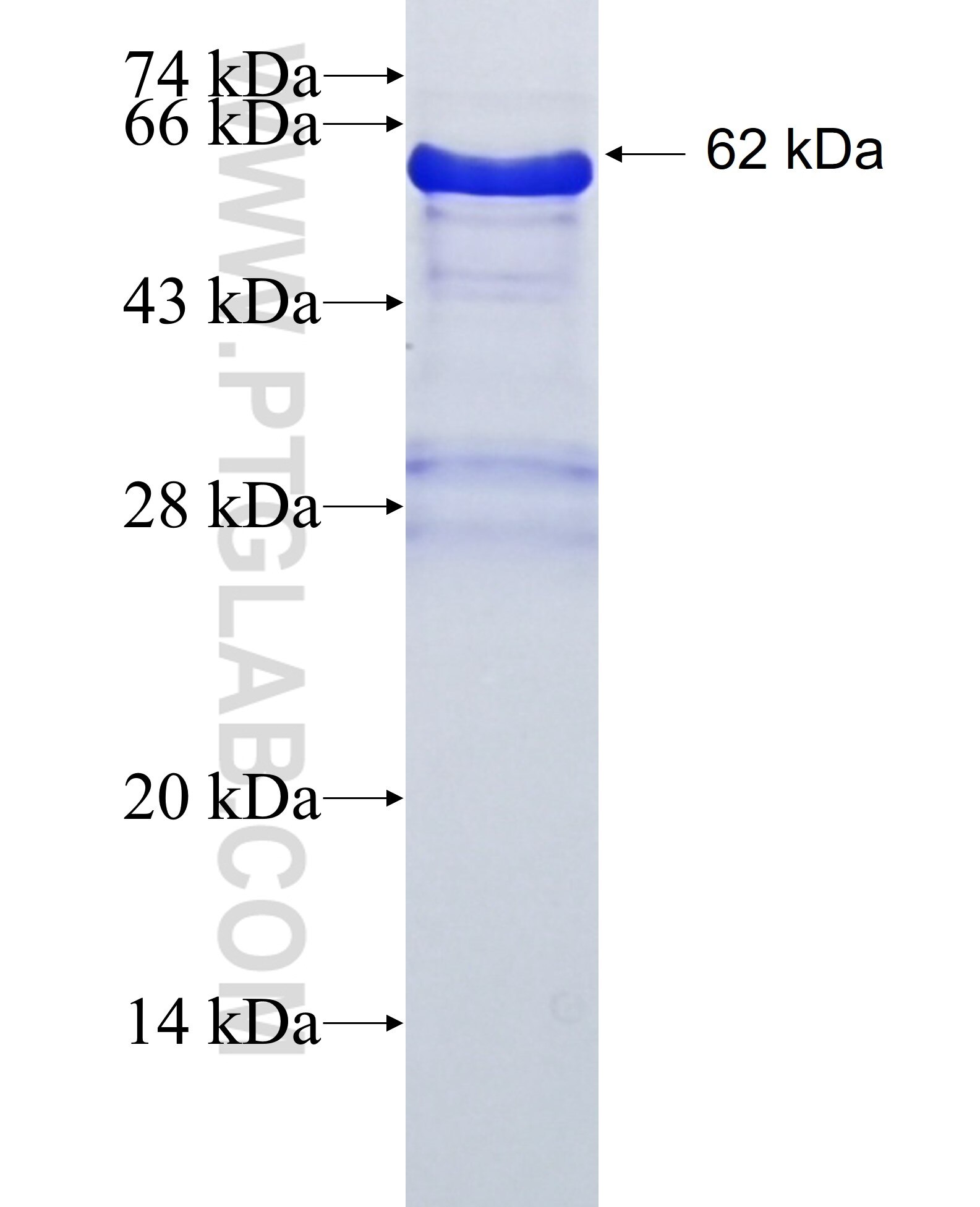 ZFP36L2 fusion protein Ag13515 SDS-PAGE