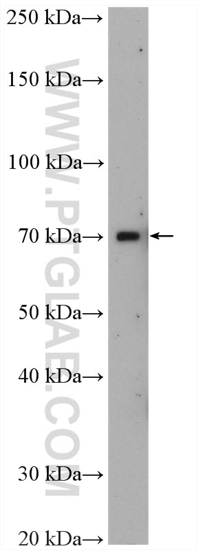 Western Blot (WB) analysis of mouse spleen tissue using ZFP64 Polyclonal antibody (17187-1-AP)